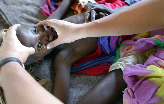 Trachoma kan medføre blindhed