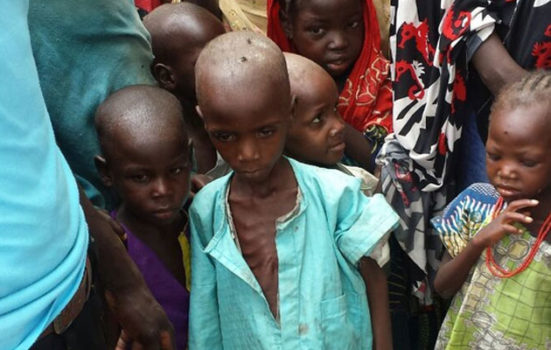 En dreng er alvorligt underernæret i de nigerianske by Bama, som Læger uden Grænser har fået adgang til.