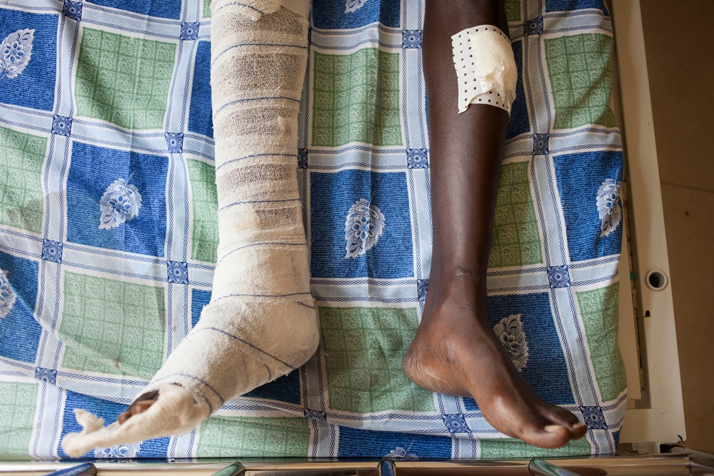 Læger uden Grænser behandler sårede under konflikten i Burundi.