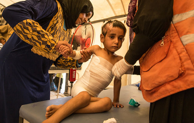 En dreng får behandling for sine skader i Syrien.