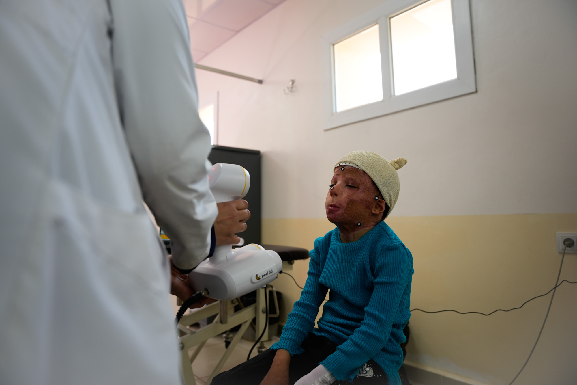 A member of the 3D-printing team takes a facial scan of a young patient with severe facial burns - Syria