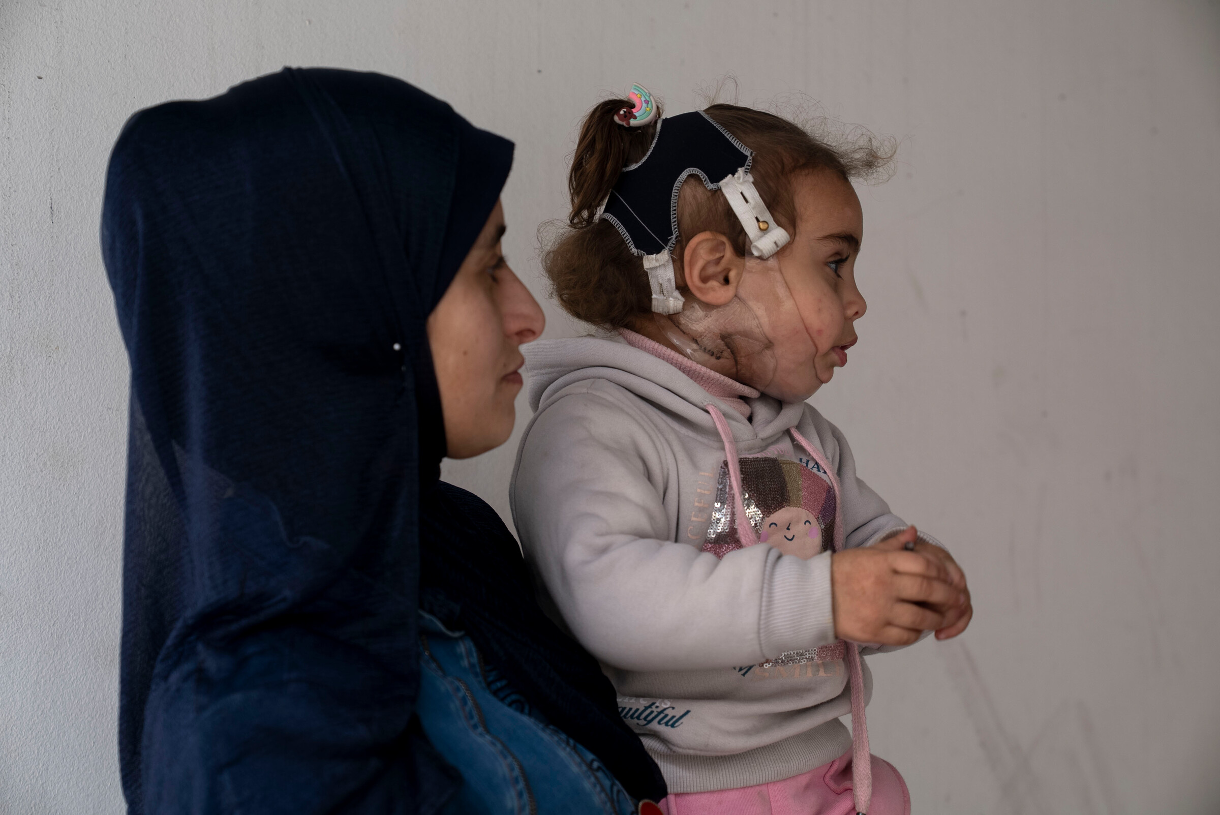 April. Gaza. Khadija, 34, holder sin to-årige datter Salam på vores klinik i Gaza By. Salam bærer en specialfremstillet 3D-printet maske, der bruges til at behandle alvorlige ansigtsforbrændinger. Hun blev forbrændt for et år siden, da luftangreb fik teltet, hvor hendes familie boede, til at ryste, så en gryde med varm mad væltede ned over hendes ansigt.